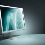 Empresas Que Apliquen Ai En RadiologÃ­a